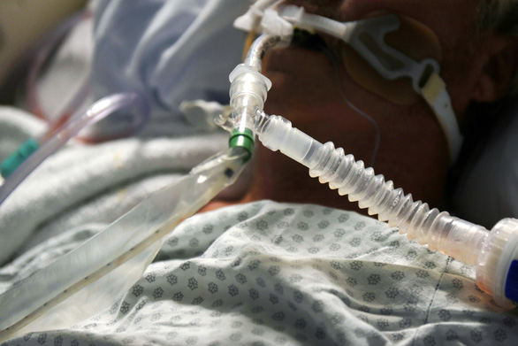 Hàng chục ngàn máy thở ở Mỹ không dùng được cho bệnh nhân COVID-19 - Ảnh 1.