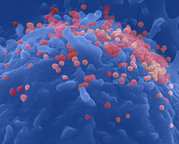 Sắp thử vắc xin ngừa HIV/AIDS trên người sau 8 năm nghiên cứu - Ảnh 3.