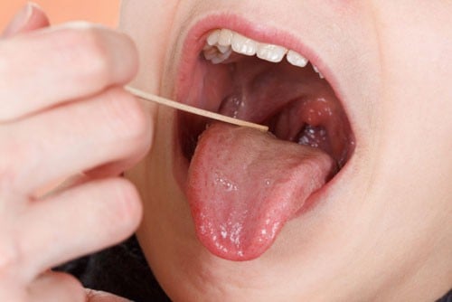 
Những bất thường ở răng sẽ gây tác động trực tiếp đến lưỡi cũng như toàn bộ khoang miệng và ngược lại. (Ảnh minh họa).
