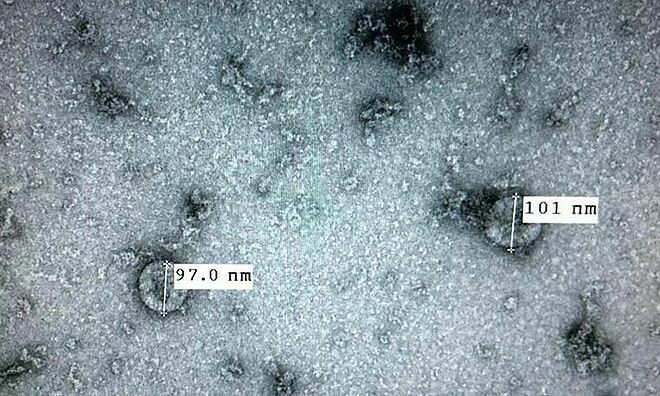 Hình ảnh virus Corona từ phòng thí nghiệm.