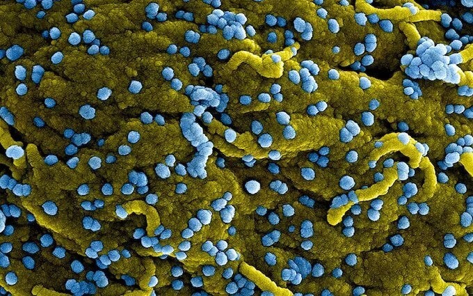 Bệnh do virus Marburg gây ra có tỷ lệ tử vong lên tới 88%. (Ảnh: Getty)