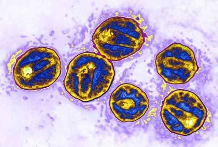 Các tế bào bị nhiễm HIV. Nguồn: Science Source