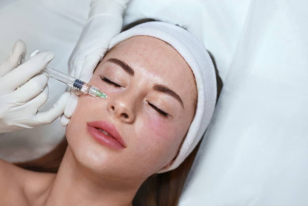 Kỹ thuật tiêm mesotherapy sử dụng những mũi kim rất nhỏ để đưa hoạt chất vào lớp trung bì của da.