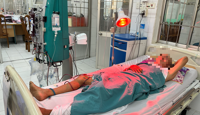 Một trong những người bị ngộ độc rượu ở đám tang, hiện đang điều trị tại Bệnh viện đa khoa Cà Mau