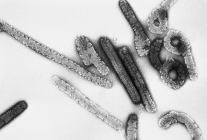Virus Marburg là một virus sốt xuất huyết nguy hiểm và hiếm gặp. Ảnh wikipedia