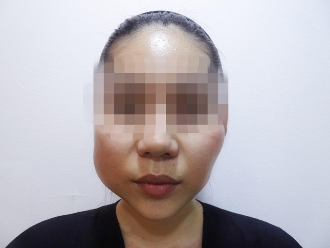 2 má của chị H luôn trong tình trạng nóng như lửa đốt, sưng phù. Ảnh: BVCC