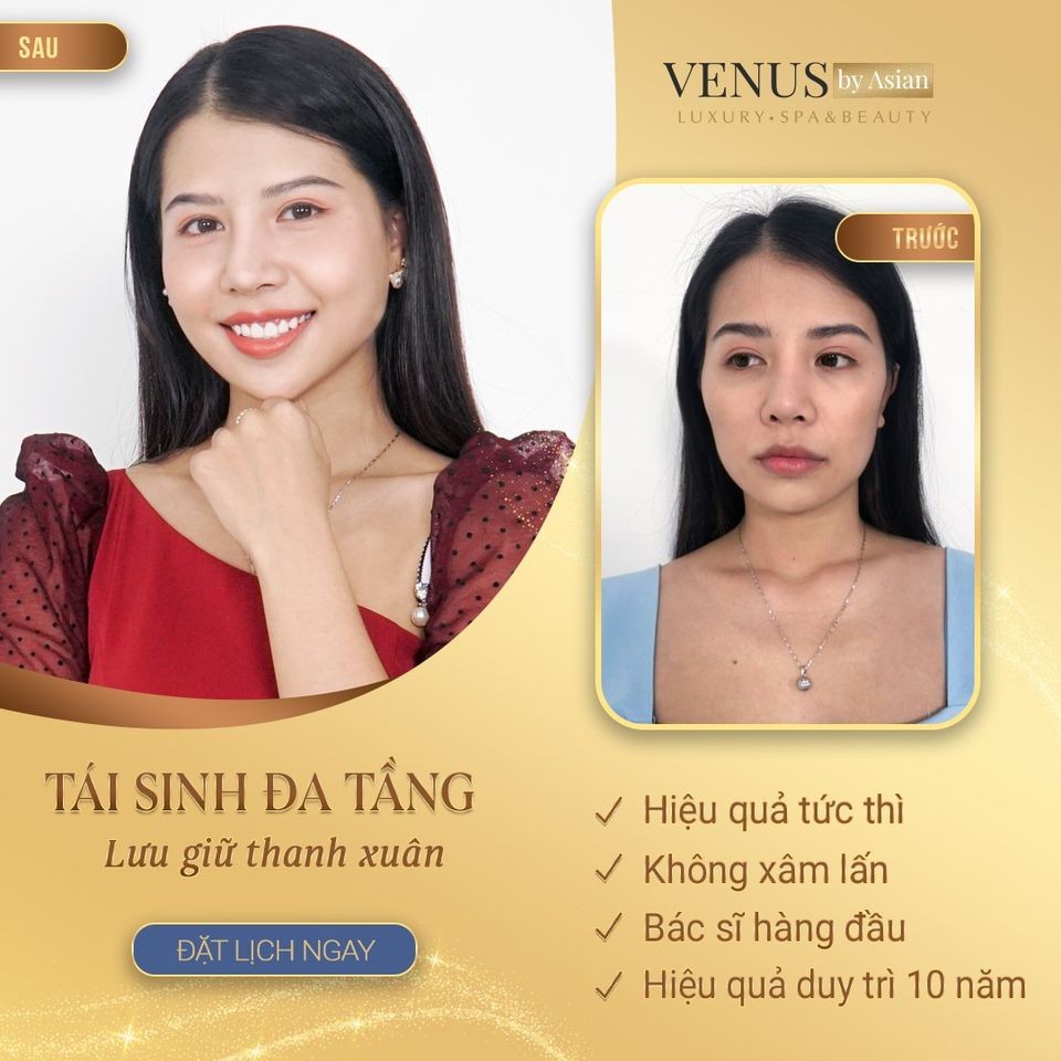 Thẩm mỹ VENUS BY ASIAN liên tiếp bị tố cáo lừa đảo, gây nguy hiểm tính mạng cho khách hàng