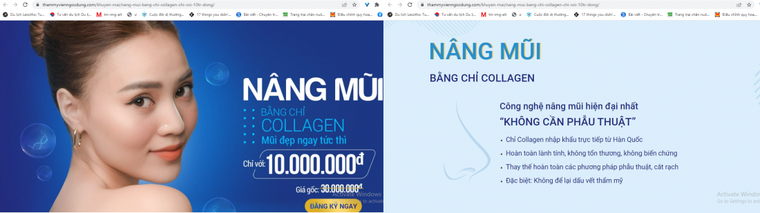 Loạn giá nâng mũi chỉ collagen tại các cơ sở thẩm mỹ