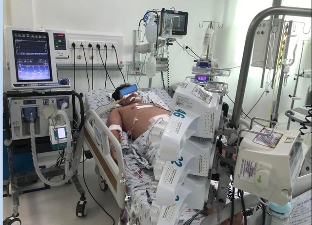 Một bệnh nhi bị sốc sốt xuất huyết dengue nặng được điều trị tại Bệnh viện Nhi đồng Thành phố. Ảnh: Sức khỏe & Đời sống
