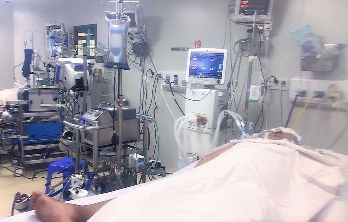 Một bệnh nhân Covid-19 nặng được chuyển từ Sóc Trăng lên điều trị ECMO tại Bệnh viện Bệnh Nhiệt đới TP.HCM trong tình trạng nguy kịch. Ảnh: BVCC.