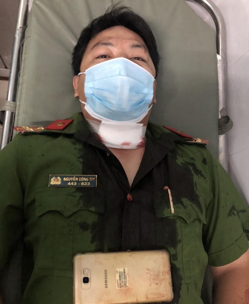 Cần Thơ: Tạm giữ người đàn ông say xỉn tấn công cảnh sát