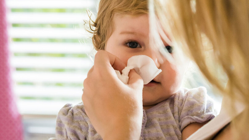Cảm cúm ở trẻ em có nhiều triệu chứng đặc trưng.
