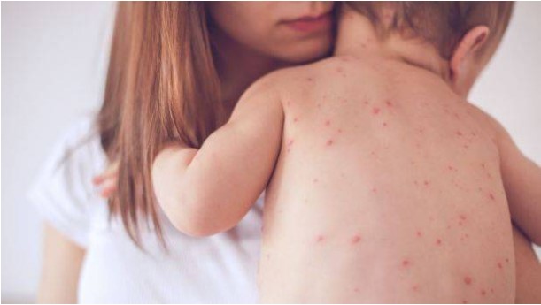 Trẻ nhỏ có nguy cơ mắc bệnh truyền nhiễm cao vì hệ thống miễn dịch chưa được hoàn thiện.