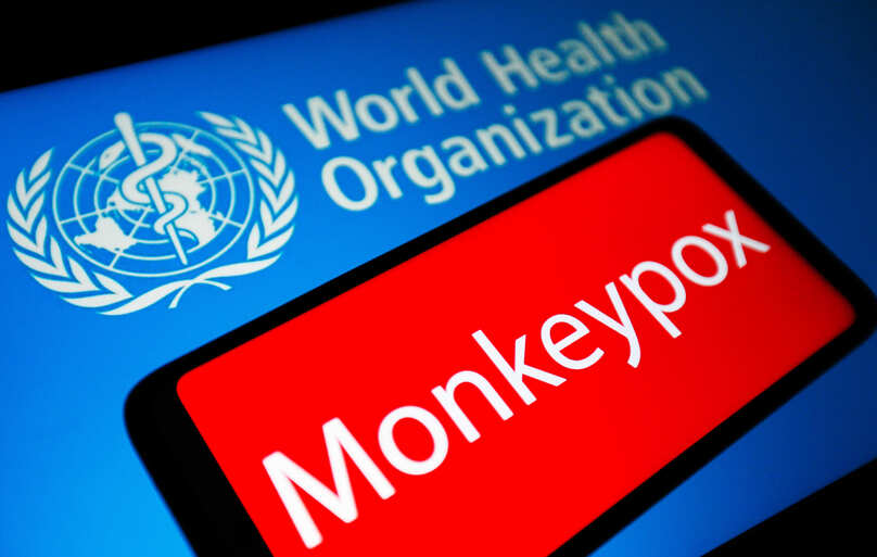 Bệnh đậu mùa khỉ đã lây lan hơn 70 quốc gia trên thế giới. Ảnh: GETTY IMAGES