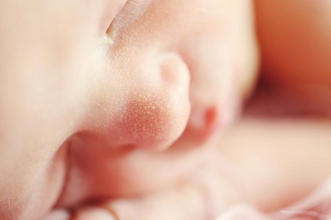 Mụn sữa ở trẻ sơ sinh có thể tự động hết trong vòng từ vài tuần đến vài tháng.