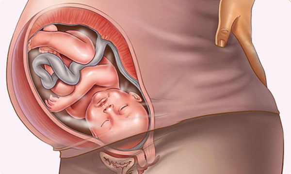 Mẹ vỡ ối sớm, thai nhi hoặc trẻ sơ sinh hít phải dịch ối nhiễm khuẩn có thể mắc các bệnh ở đường hô hấp.