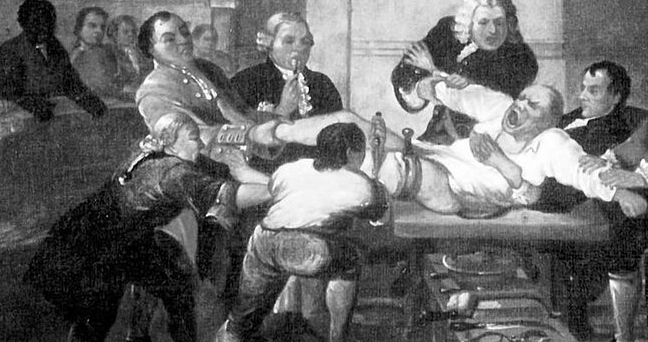 Trước khi phát hiện ra thuốc gây mê, bệnh nhân được phẫu thuật trong trại thái tỉnh tảo, chân tay bị ghìm chặt. (Ảnh: The best History Encyclopedia)