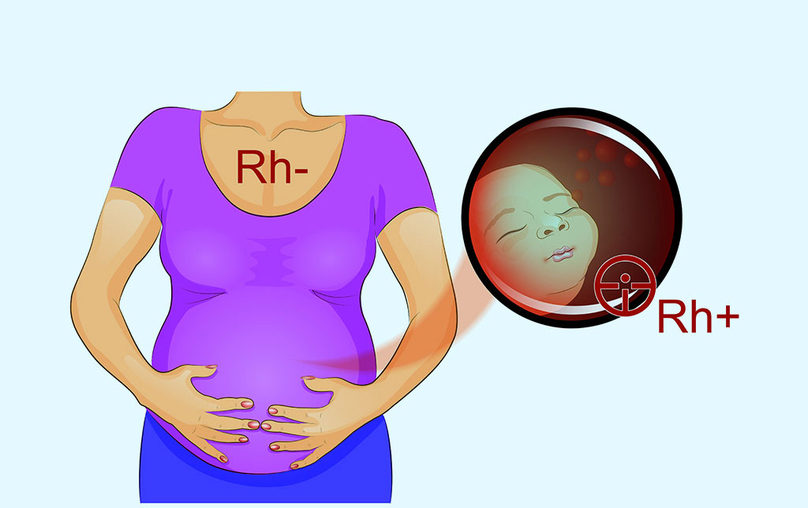 Với phụ nữ mang thai, xét nghiệm nhóm máu và xét nghiệm yếu tố Rh là một trong những xét nghiệm máu thường quy trong thai kỳ, nhằm sàng lọc để phát hiện sự tương thích máu trong cơ thể mẹ và bé.