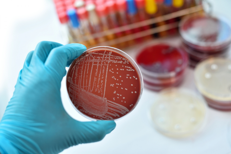 Các nhà khoa học Mỹ phát hiện đột biến ức chế vi khuẩn gây ra bệnh lậu. Ảnh minh họa