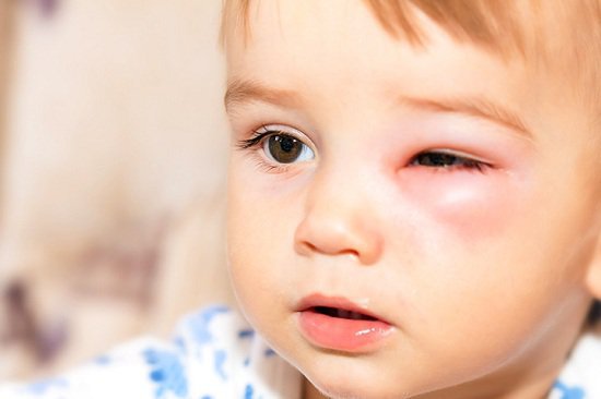 Người bệnh đau mắt đỏ nên đến các cơ sở y tế để được chẩn đoán và điều trị kịp thời.