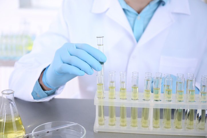Protein niệu có thể dễ dàng được phát hiện khi đi khám, thông qua xét nghiệm mẫu nước tiểu đơn giản.