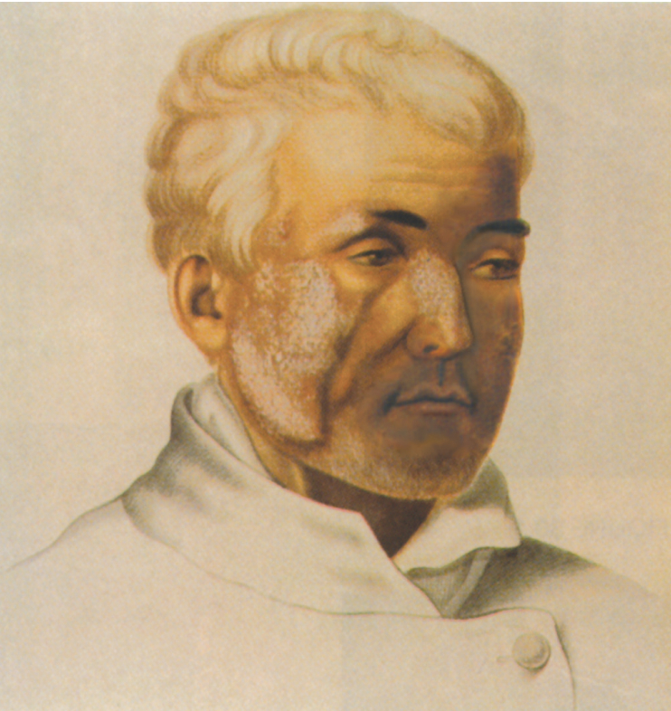 Hình minh họa hiện đại đầu tiên về bệnh lupus ở da, được dán nhãn “Lupus érythémateux,” ở Cazenave11 Paris năm 1856.