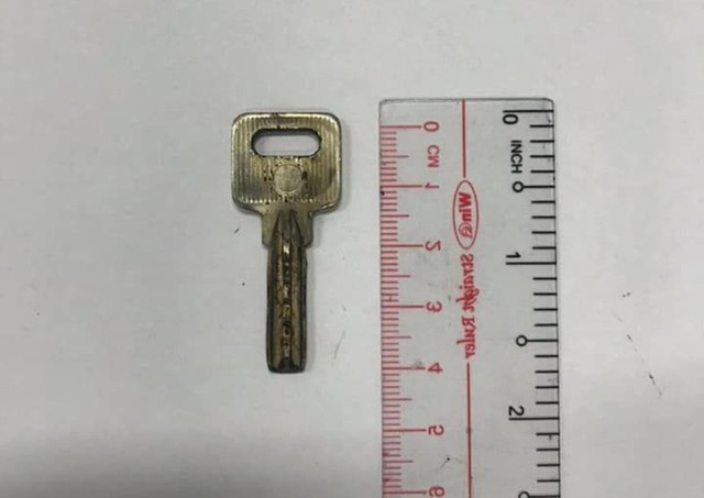  Chiếc chìa khóa có kích thước 2x4cm được lấy ra từ thực quản bé trai.