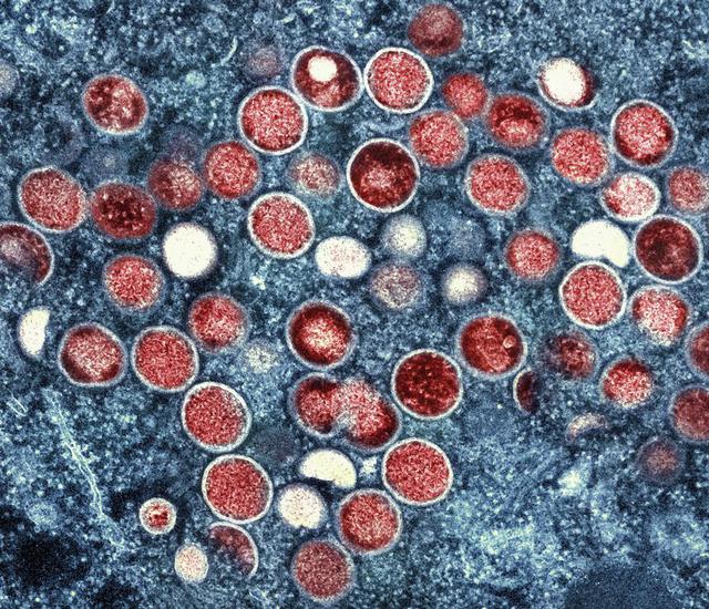  Hình ảnh hiển vi điện tử truyền màu của các hạt đậu mùa khỉ (màu đỏ) được tìm thấy trong một tế bào bị nhiễm bệnh (màu xanh lam). Viện Quốc gia về Dị ứng và Bệnh truyền nhiễm (NIAID)