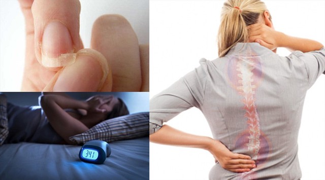 Cách nhận biết thiếu canxi và thời điểm nên bổ sung