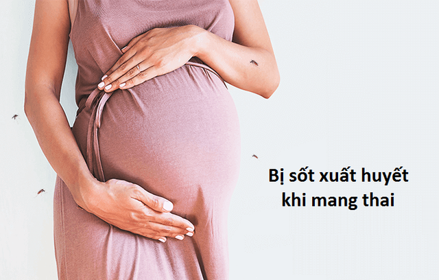  Sốt xuất huyết khi mang thai là tình trạng nguy hiểm cần được theo dõi và xử lý kịp thời.