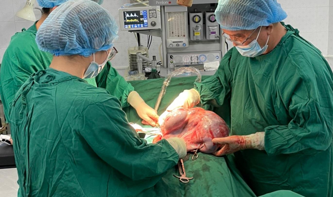  Các bác sĩ tiến hành phẫu thuật lấy khối u nang buồng trứng cho bệnh nhân.