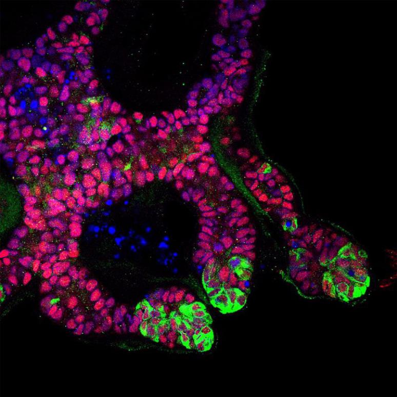  Các organoids chồi niệu quản thận của con người có nguồn gốc từ tế bào gốc và được nhuộm màu cho các protein khác nhau. (Ảnh do Phòng thí nghiệm của Bonventre, Bệnh viện Brigham và Phụ nữ cung cấp)