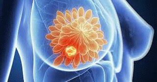 Nguyên nhân nào khiến các tế bào ung thư hoạt động trong một cơ thể bình thường?