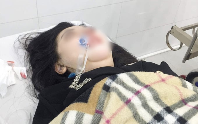 Chị Phạm Thị Diễm H. (22 tuổi, quê ở Long An) tử vong sau khi đi phẫu thuật thẩm mỹ nâng mũi. Ảnh: TL