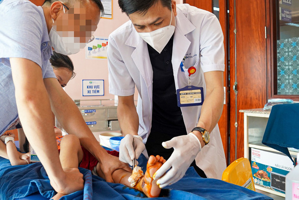 Bệnh nhi nhập viện trong tình trạng bàn chân bị giập nát - Ảnh: Bệnh viện cung cấp
