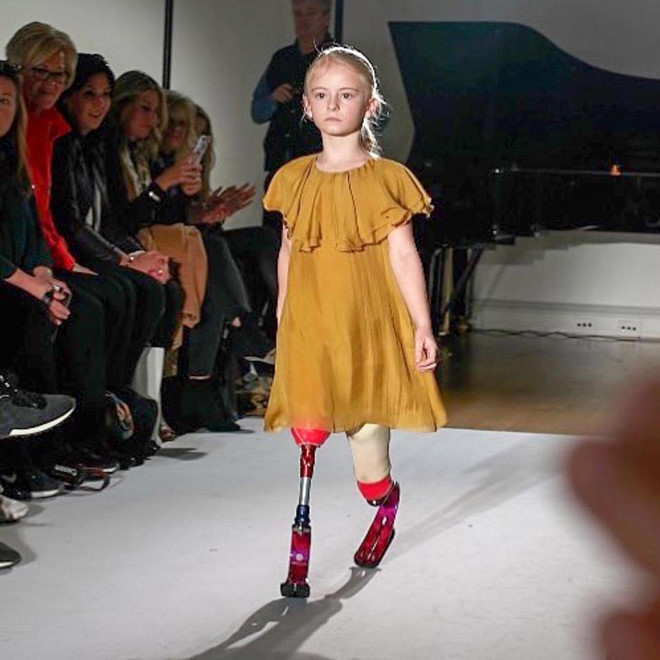 Từ cô bé cụt hai chân đến người mẫu hãng thời trang nổi tiếng