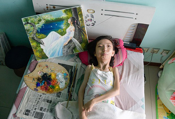 Người phụ nữ liệt giường 32 năm trở thành họa sĩ nổi tiếng