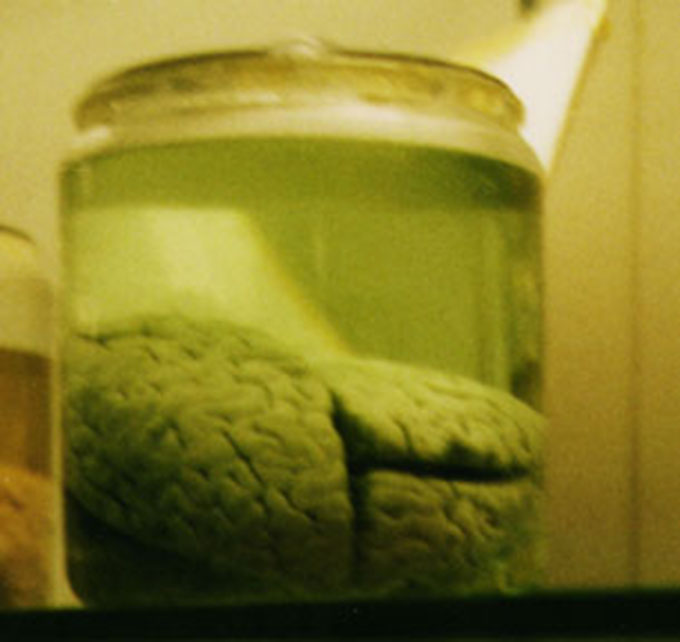 Bộ não của Rulloff được ngâm trong phoóc – môn và hiện vẫn đang được lưu giữ.