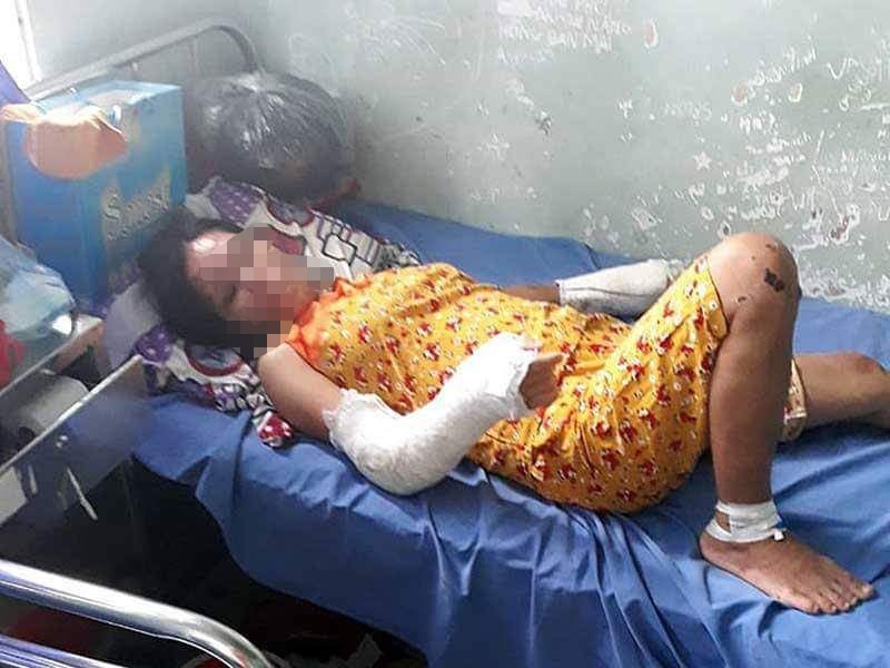 chồng đánh vợ mang thai gãy tay ở Bình Thuận