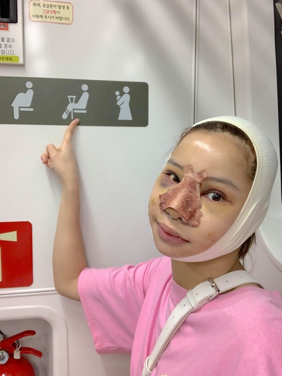 Cô tự tin ra ngoài đường phố Hàn Quốc với gương mặt băng bó. 