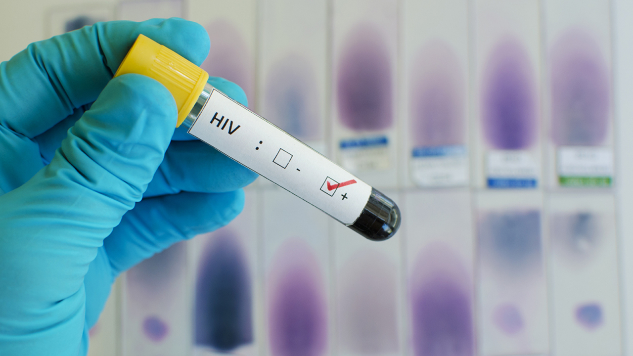 Các nhà khoa học phát hiện ra chủng HIV mới đầu tiên sau gần hai thập kỷ