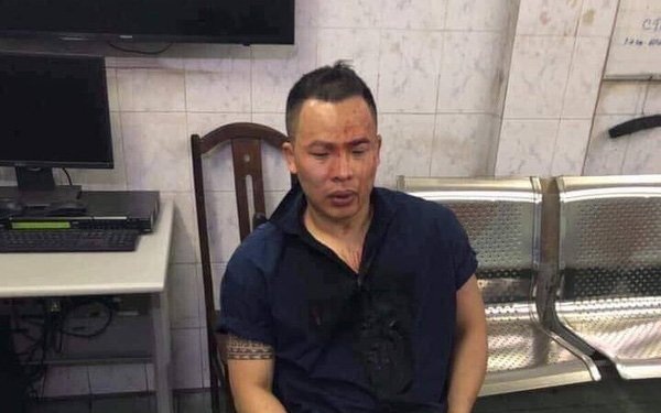 Hình ảnh Vũ Khăc Tiệp be bét máu gây xôn xao dư luận.