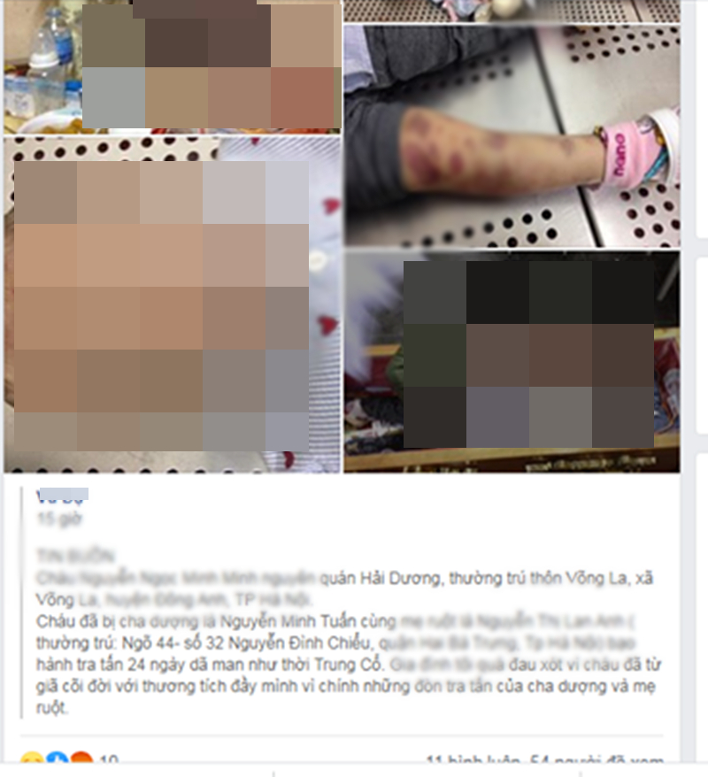 Hình ảnh cháu bé gái 3 tuổi nghi bị bạo hành đến chết ở Hà Nội với những vết thương khắp cơ thể.