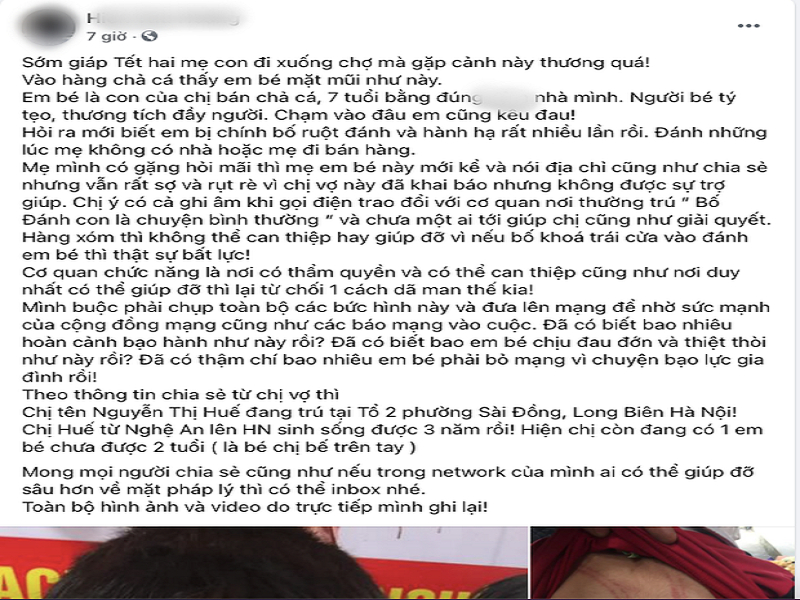Thông tin cháu bé bị bố bạo hành ở Hà Nội lan truyền trên mạng xã hội.