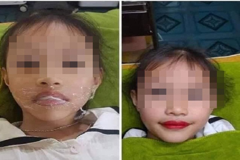 Hình ảnh bé gái 5 tuổi được xăm môi rồi đăng lên mạng xã hội gây tranh cãi.