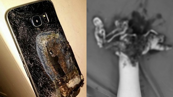 Điện thoại phát nổ khi học trực tuyến nam sinh lớp 5 tử vong ở Nghệ An. (Ảnh minh họa).