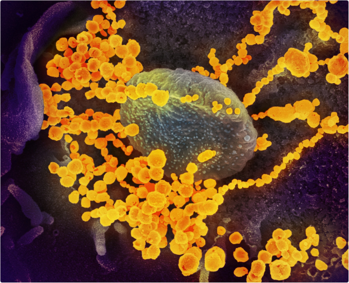 Hình ảnh kính hiển vi cho thấy SARS-CoV-2 (vật thể vàng tròn) trên bề mặt tế bào nuôi cấy trong phòng thí nghiệm.