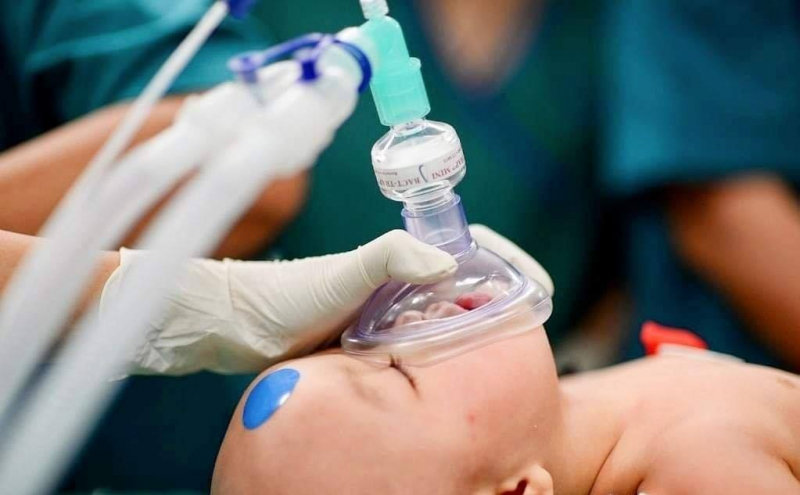 Ca mổ tách hai bé song sinh đang được tiến hành tích cực. Ảnh: FB Bệnh viện Nhi đồng Thành phố