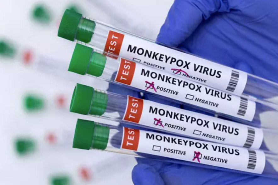 Bệnh đậu mùa khỉ đã lan ra 30 quốc gia trên thế giới.