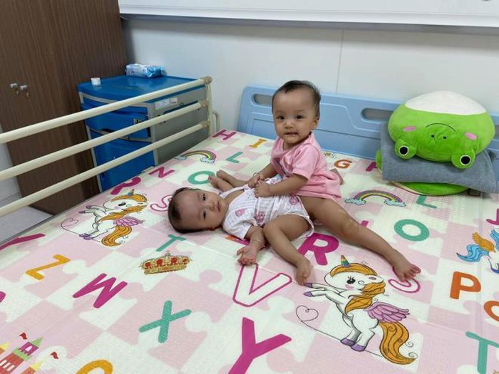 2 bé song sinh dính liền Trúc Nhi - Diệu Nhi đã được tách rời hoàn toàn trong niềm vui vỡ òa của gần 100 bác sĩ.